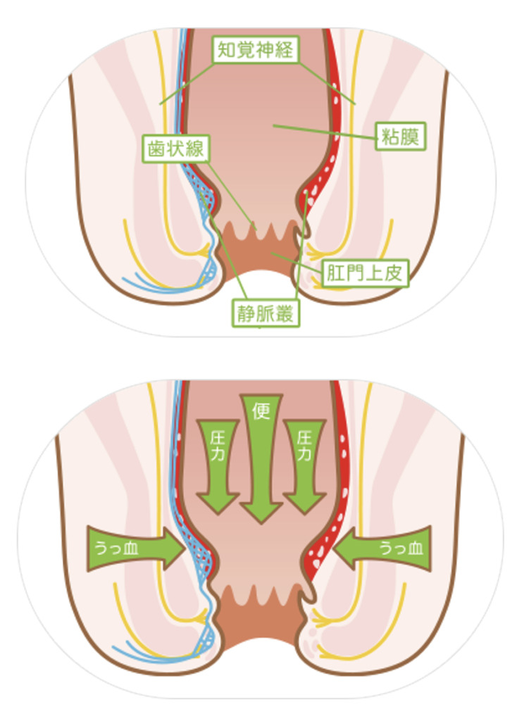 肛門の仕組みと痔核ができるメカニズム